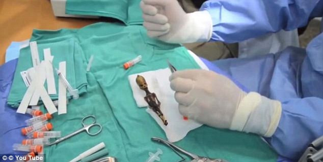 Trên thực tế, bé gái sơ sinh này chỉ có 10 cặp xương sườn thay vì 11, một đặc điểm chưa bao giờ gặp ở con người trước đây.