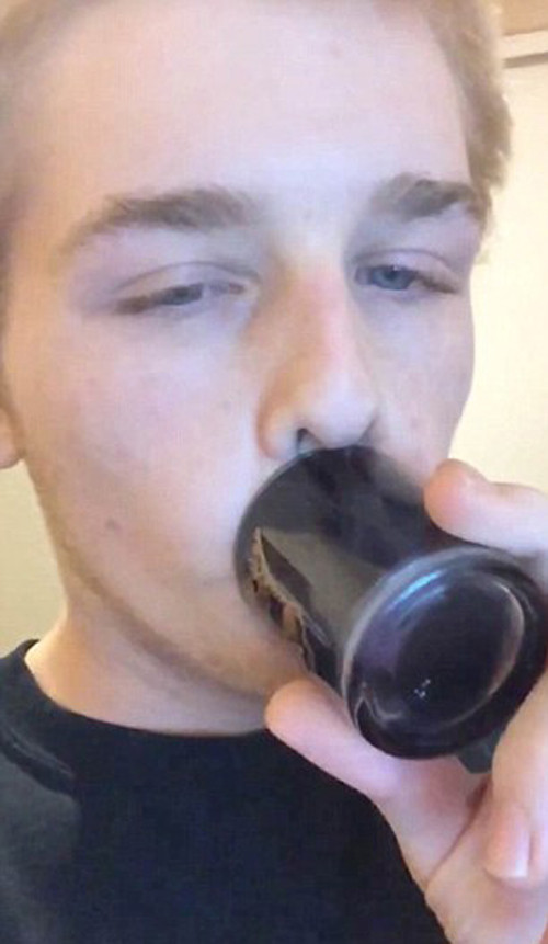 Nhiều người tỏ ra hài lòng với kết quả đạt được song không ít trường hợp môi trở nên bầm tím, sưng và viêm nhiễm đau đớn do tận dụng cốc, nắp chai làm đẹp.