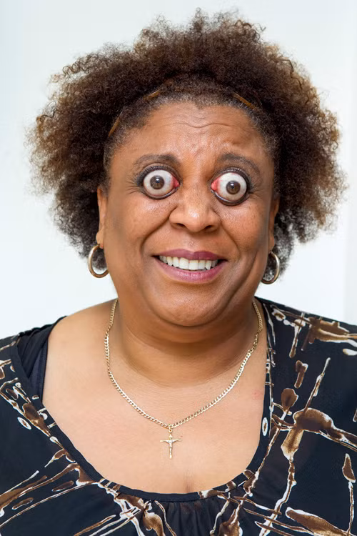 Không nổi tiếng với ngực “khủng”, Kim Goodman lại gây chú ý với khả năng khiến phần tròng mắt lộ hẳn ra bên ngoài. Cô tình cờ phát hiện khả năng này trong một lần bị cây gậy hockey đánh trúng đầu.