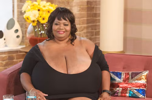 Trong khi Myra hạnh phúc với khuôn ngực “khủng” thì Annie Hawkins – Turner lại thấy bộ ngực lớn như một gánh nặng. Cô cảm thấy đau khổ khi phải nghe những lời chế giễu từ người lạ.