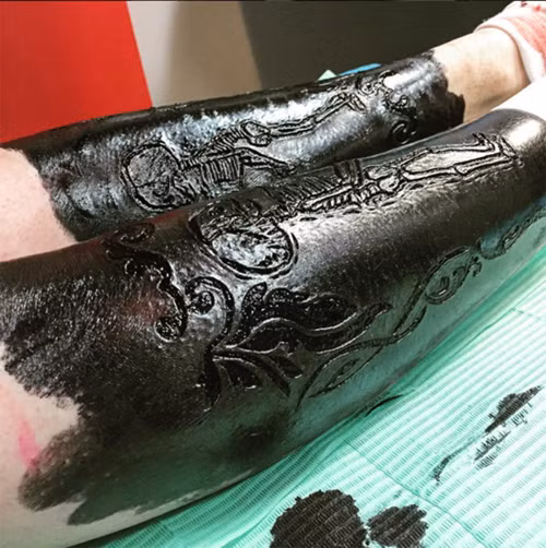 Theo anh, “Xăm kiểu “rạch vỏ cây” không có gì quá khác biệt so với các phương pháp phẫu thuật thẩm mỹ khác. Nó cũng không gây đau đớn nhiều như bạn tưởng. Thậm chí, nỗi đau nó mang lại không lớn hơn so với nỗi đau bạn có thể chịu đựng tại các phòng tập.