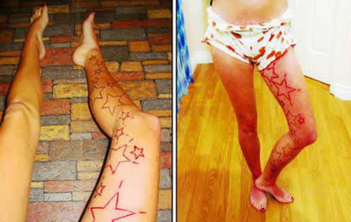 Dù vậy, khó có thể tin được việc rạch, tách một phần thịt khỏi cơ thể bằng một con dao khiến bạn cảm thấy thoải mái.