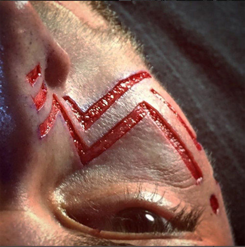 Yann Brenyak được xem là một trong những chuyên gia xăm mình đi đầu trong phương pháp xăm hình trên. Yann từng đăng tải lên mạng xã hội những thiết kế phức tạp. Trong số đó, có những thiết kế mô phỏng chân dung, đầu lâu và các mô hình có tính đối xứng.