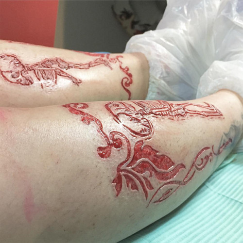 Swiss cũng là một chuyên gia sinh sống tại London. Tài khoản Instagram của Swiss thu hút hơn 15.000 người theo dõi. Trên trang của mình, Swiss liên tục nhấn mạnh việc thực hiện hình xăm như vậy không có gì là quá khủng khiếp.