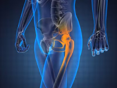 Đau háng được xem là một trong những dấu hiệu sỏi thận ở phụ nữ. Đau háng thường xảy ra khi đi tiểu – thời điểm viên sỏi được đẩy ra từ niệu đạo.