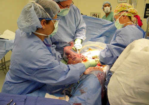 Một ca mổ đẻ.