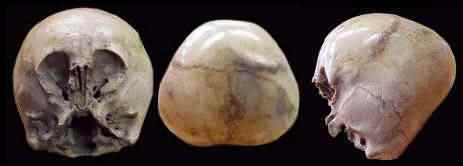 Họ đã giấu kín hộp sọ này cho trong nhiều thập niên. Phải đến năm 1999, người thân của họ mới mang hộp sọ này giao cho nhân viên nghiên cứu. Sự kiện này đã khiến giới khoa học thời điểm đó chấn động.