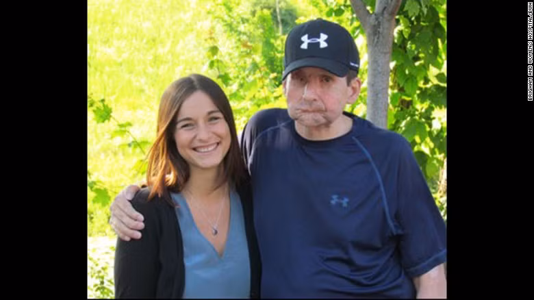 30/6/2005, James Maki bị rơi xuống đường ray xe điện khiến khuôn mặt anh gần như bị nghiền nát hoàn toàn. Anh đã phải trải qua rất nhiều ca phẫu thuật cấy ghép để có được khuôn mặt như hiện nay. 