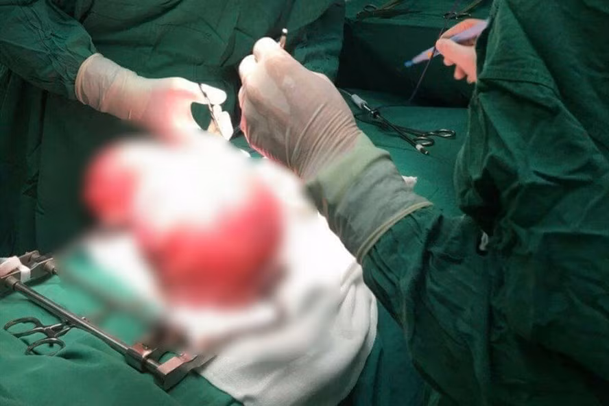 Các bác sĩ tiến hành phẫu thuật.