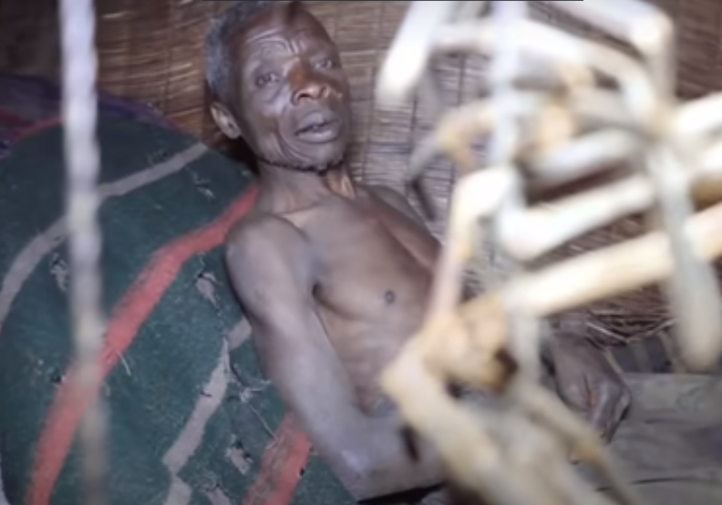 Chứng sợ phụ nữ có thể dẫn đến sự cô lập về mặt xã hội, lo âu, hoảng loạn, thậm chí trầm cảm nếu không được điều trị.