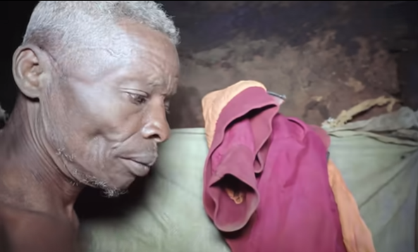 Nguyên nhân chính xác của chứng sợ phụ nữ vẫn chưa được xác định rõ, nhưng có thể là do những trải nghiệm tồi tệ trước đây với phụ nữ, yếu tố môi trường, di truyền hoặc những thay đổi trong cách hoạt động của não bộ...