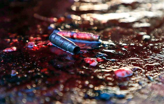 Hình ảnh đẫm máu trong cuộc biểu tình với vỏ đạn cao su của cảnh sát. Nguồn ảnh: AP.