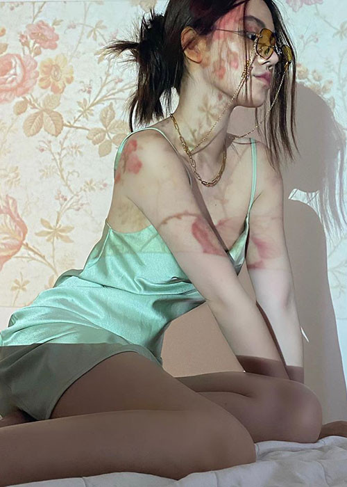 Jolie Nguyễn tiết lộ, cô có nhiều may mắn hơn trong sự nghiệp sau khi sửa mũi.