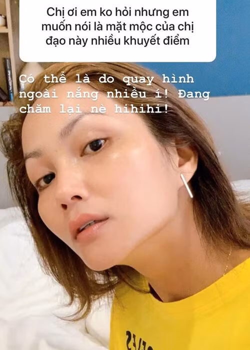 H'hen Niê cho biết, do quay hình quá nhiều dưới nắng nên làn da của cô đang bị lão hóa. Hiện tại, chân dài bắt đầu trở lại quá trình chăm sóc da.