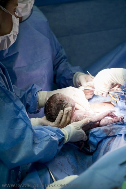 Nhiếp ảnh gia chuyên chụp ảnh sinh nở Daniela Justus đã chia sẻ niềm hạnh phúc của cặp vợ chồng bằng cách ghi lại khoảnh khắc sinh mổ 3 bé chào đời.