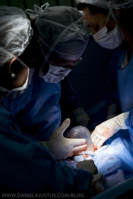 Ba đứa bé được sinh ra hoàn toàn khỏe mạnh và em bé út ít sinh ra bên trong một túi ối. 