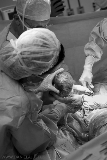 Và giây phút cắt dây nối với rốn của mẹ đầy ý nghĩa.