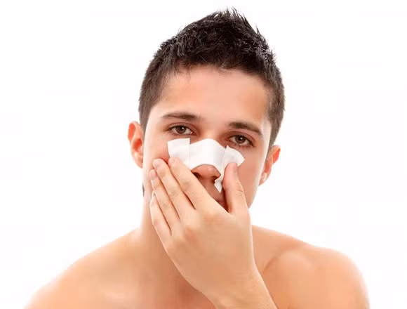 Nhiễm trùng xoang. Nếu bạn thấy máu cam có màu đậm và mùi hôi thì đây có thể là dấu hiệu của nhiễm trùng xoang. Đi kèm dấy hiệu như nghẹt mũi, thường ở một bên, đau trán, mũi, quanh mắt, chảy dịch cửa mũi và thường mất cảm giác mùi. Nếu không điều trị sớm có thể phát triển thành ung thư mũi xoang.