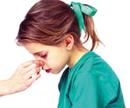 Dị ứng. Thường thì khi bị dị ứng, cơ thể sẽ phản ứng lại khiến các mô sưng lên. Khi mô dọc mũi sưng thì mao mạch dãn nở, nếu nó căng quá mức có thể bị vỡ, gây chảy máu khi hắt xì hơi hoặc xì mũi.