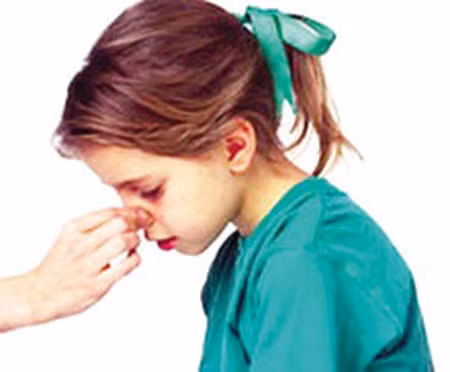 Dị ứng. Thường thì khi bị dị ứng, cơ thể sẽ phản ứng lại khiến các mô sưng lên. Khi mô dọc mũi sưng thì mao mạch dãn nở, nếu nó căng quá mức có thể bị vỡ, gây chảy máu khi hắt xì hơi hoặc xì mũi.