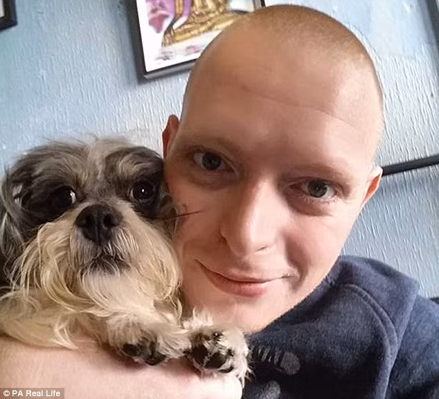 Jamie Lee Carter, 25 tuổi bị bệnh hiếm gặp gangrenosum ( viêm da hoại tử) ăn lở loét khắp cơ thể khiến sinh hoạt khó khăn.