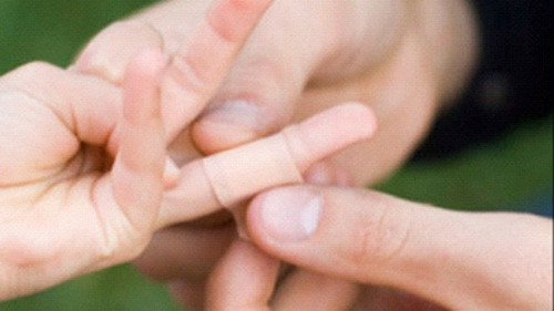 Dùng băng dính để lấy dằm ra khỏi da. Chỉ cần một miếng băng dính để dính vào nơi dằm thì bạn sẽ lấy nó ra hết sức dễ dàng không cần kẹp hay kim.