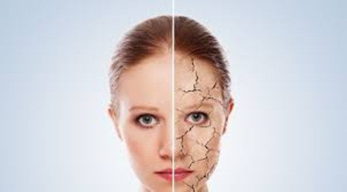 Da khô. Đây là điều hiển nhiên đối với bất kỳ ai. Muốn có làn da đẹp thì phải uống nước. Tuy nhiên, lượng nước lọc hoặc nước trái cây mới hiệu quả. Cà phê và bia rượu sẽ càng khiến cơ thể rút cạn nước hơn.