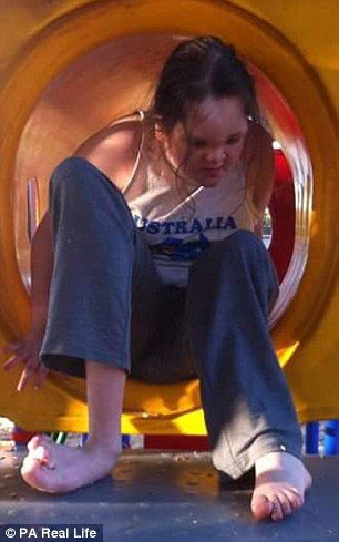 Bà Punch mẹ Tori kể lại, khi mang thai 3 tháng, siêu âm thai nhi cho biết, con bà có chất lỏng trong não và có thể bị hội chứng down. Thế nhưng bà vẫn quyết định giữ lại con cho đến khi sinh bé Tori ra đời khỏe mạnh.