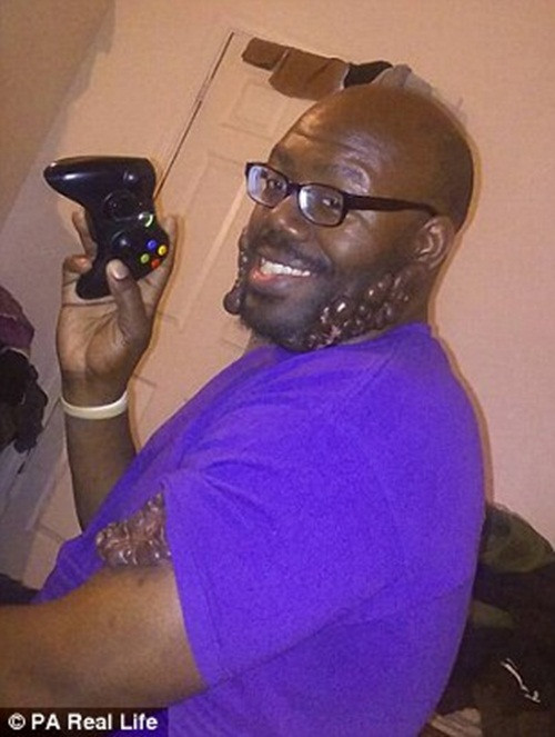 “Mỗi khi nhìn vào gương, tôi lại có cảm giác cuộc đời mình không lối thoát. Tôi sợ bước ra ngoài, tôi sợ việc người xung quanh phải chấp nhận mình”.