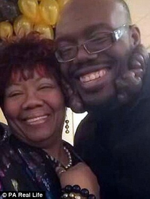 Ngày trước, anh đã trải qua cuộc phẫu thuật phức tạp 28 giờ đồng hồ để loại bỏ các mô nhưng sau đó sẹo lồi lại lớn hơn. Sau đó, mỗi vài năm anh lại phải phẫu thuật, nhưng mỗi lần hậu phẫu thì nó lại lớn gấp 3 lần.