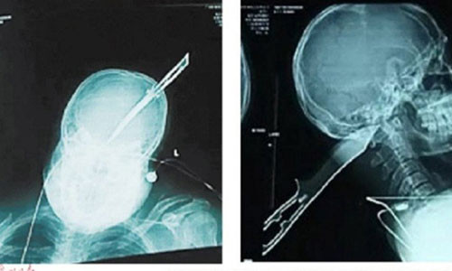 Bi dao dam xuyen dau van lai xe may di bao cong an