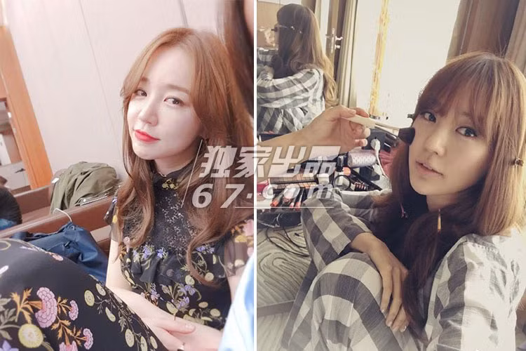 Nhiều người cho rằng Yoon Eun Hye đã quá lạm dụng phẫu thuật thẩm mỹ.