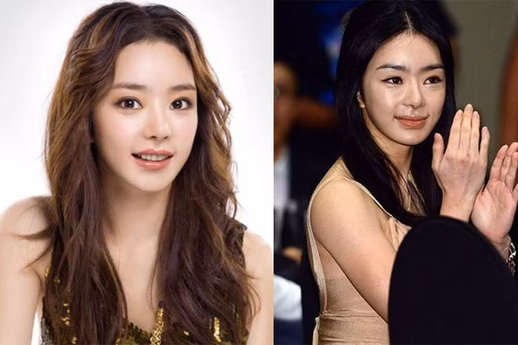 Seo Woo từng được ví như búp bê sau khi tác động dao kéo lên gương mặt. Nhưng vì nghiện thẩm mỹ, gương mặt của nữ diễn viên bị biến dạng.