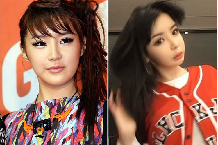 Khó có thể nhận ra Park Bom hiện tại do phẫu thuật thẩm mỹ quá đà.