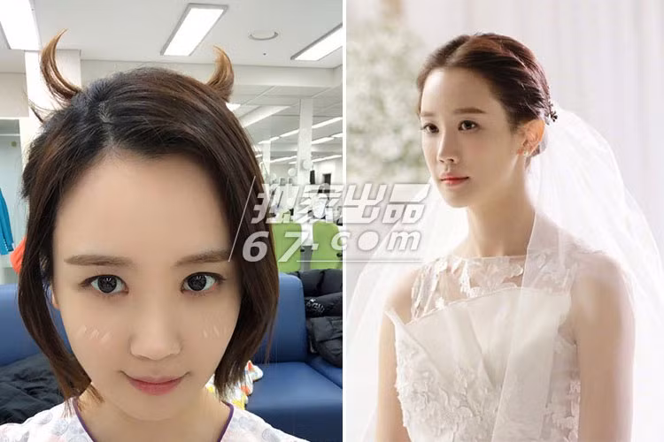 Gương mặt của Lee Da Hae thay đổi không ít sau khi cô tiếp tục chỉnh sửa nhan sắc.