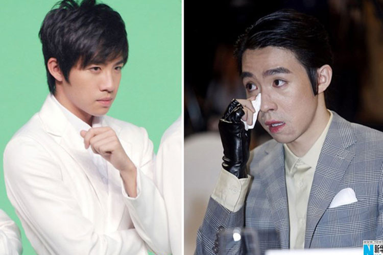 Gặp tai nạn phim trường cùng Selina là Du Hạo Minh. Anh bị bỏng 39% và cũng phải phẫu thuật nhiều lần. Ảnh: Koreaboo