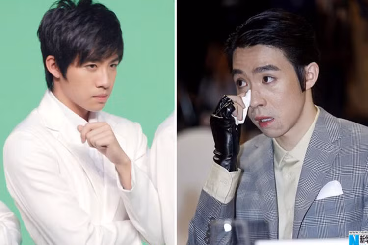 Gặp tai nạn phim trường cùng Selina là Du Hạo Minh. Anh bị bỏng 39% và cũng phải phẫu thuật nhiều lần. Ảnh: Koreaboo