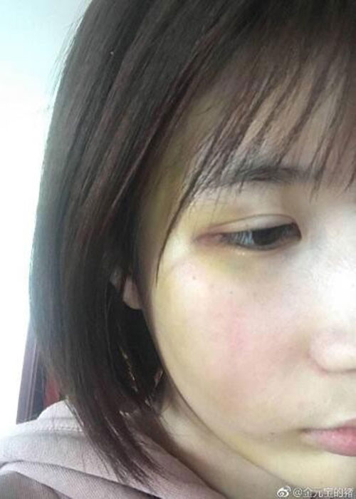 Sau lời tố của Đại Kim, Hứa Khải thừa nhận từng bồng bột nhưng không bạo lực với bạn gái cũ hay lăng nhăng. Ảnh: Weibo