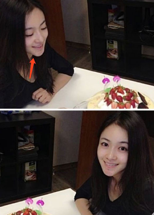 Nhiều người cho rằng Ngô Cẩn Ngôn đã dao kéo ở phần cằm.