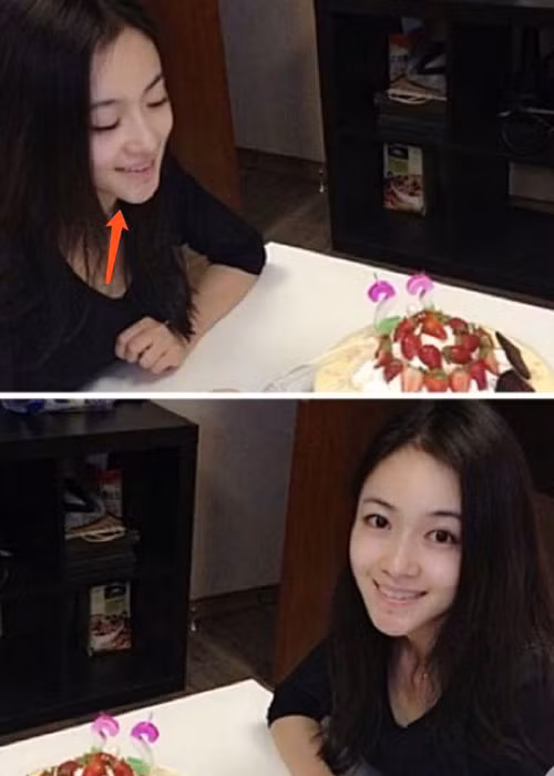 Nhiều người cho rằng Ngô Cẩn Ngôn đã dao kéo ở phần cằm.