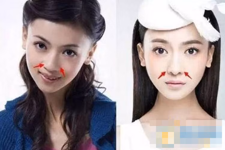 Ngoài cằm, mũi của Ngô Cẩn Ngôn cũng được cho là đã dao kéo với phần cánh mũi thon gọn hơn so với trước kia.