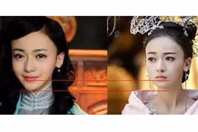 Khi đóng "Phong hỏa giai nhân" năm 2013, Ngô Cẩn Ngô có phần cằm dài bất thường. Đến năm 2017, khi đóng "Triều Ca", phần cằm của cô lại thon gọn tự nhiên.