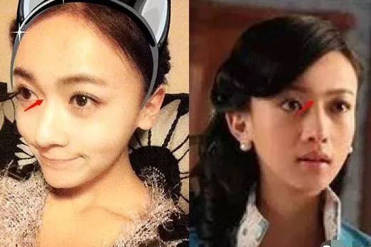 Nữ diễn viên phim "Diên Hi Công Lược" còn vướng nghi vấn chỉnh sửa hốc mắt để mắt thêm to tròn.