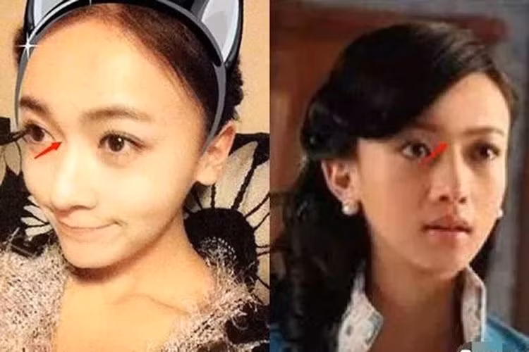 Nữ diễn viên phim "Diên Hi Công Lược" còn vướng nghi vấn chỉnh sửa hốc mắt để mắt thêm to tròn.