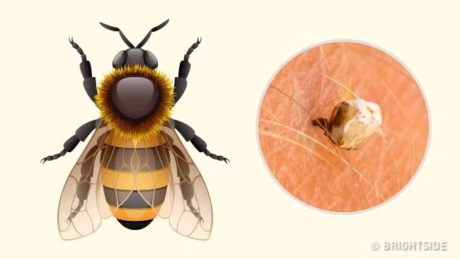 Ong thường đốt: Đa phần các loài ong đều có nọc, tùy theo loài mà sẽ độc ít hay nhiều. Có loài ong không độc như ong mật. Khu vực da bị ong đốt thường đỏ và sưng tấy. Bạn sẽ cảm thấy nóng, đau dữ dội và ngứa ngáy ngay sau khi bị ong đốt. Nếu bạn không bị dị ứng nọc ong thì chẳng sao cả. Tuy nhiên, nếu ai đó bị dị ứng với nọc ong rất có thể gặp một số vấn đề về hô hấp, thậm chí rất nghiêm trọng. Ảnh: Brightside.