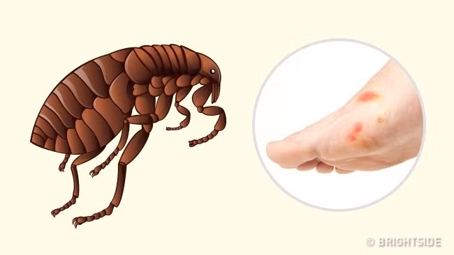 Bọ chét: Vết bọ chét cắn có thể dễ dàng bị nhầm lẫn là dị ứng hoặc muỗi đốt bởi vết cắn cũng có màu đỏ và sưng lên. Tuy nhiên, không giống như muỗi đốt, những vết cắn của bọ chét thường gây đau và ngứa hơn nhiều. Một con bọ chét có thể cắn nhiều lần, vì vậy những vết đốm đỏ trên da thường cách nhau từ 1-2cm. Bọ chét thường truyền nhiều bệnh nhiễm trùng nghiêm trọng. Ảnh: Brightside.