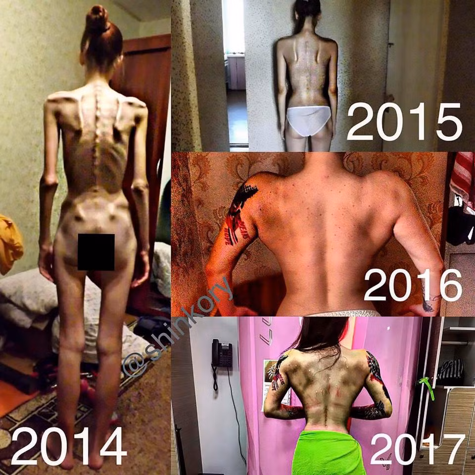 Vera đã chủ động thay đổi cuộc sống của mình khi cảm thấy chế độ ăn uống của cô bắt đầu có ảnh hưởng nghiêm trọng đến sức khoẻ. Vera nhớ lại: "Tôi bị thiếu không khí, thường xuyên ngất xỉu. Tôi sống ở tầng 5 của tòa nhà và tôi cần khoảng một giờ leo lên vì không có thang máy". Ảnh: CEN.