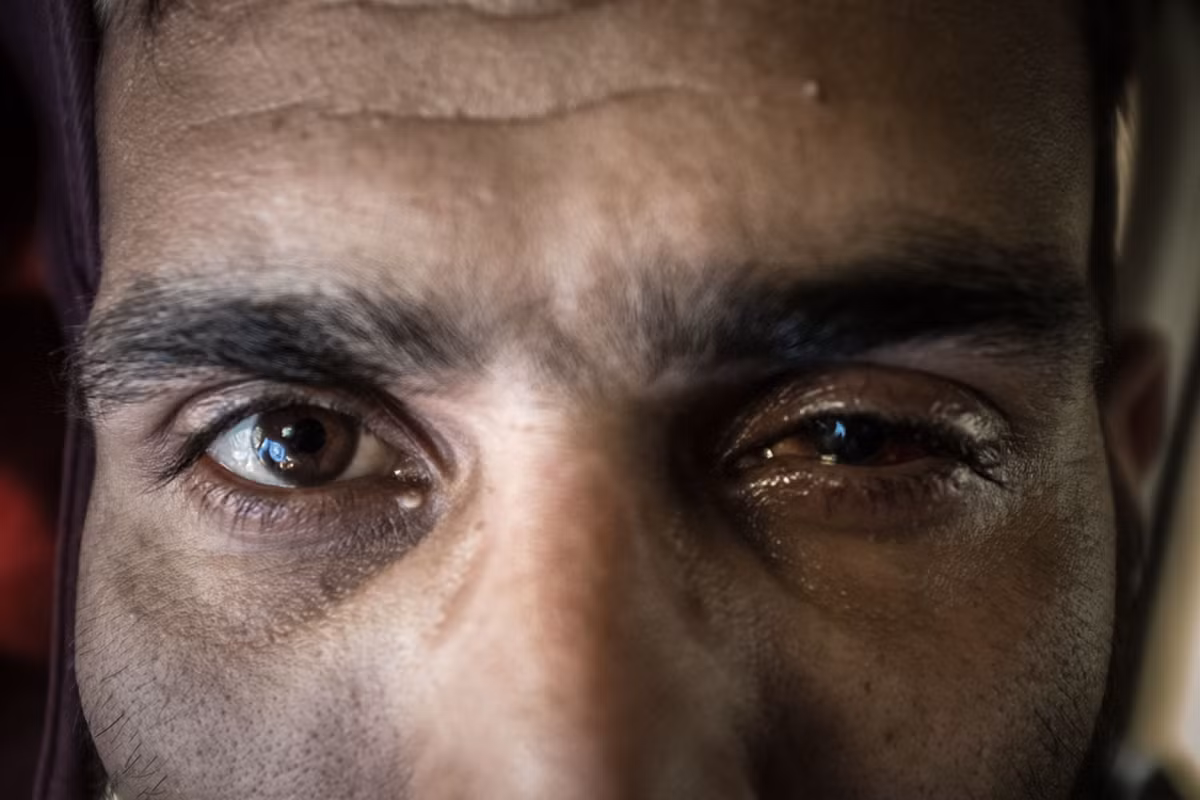 Một thanh niên Kashmir 26 tuổi đã bị mù mắt trái trong các cuộc đụng độ. Ảnh: Al Jazeera.