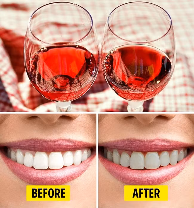 8. Rượu vang đỏ: Rượu vang đỏ không thực sự ảnh hưởng đến sức khoẻ của răng nhưng nó làm thay đổi màu sắc tự nhiên khiến hàm răng xám xỉn đi. Ảnh: Pixabay.