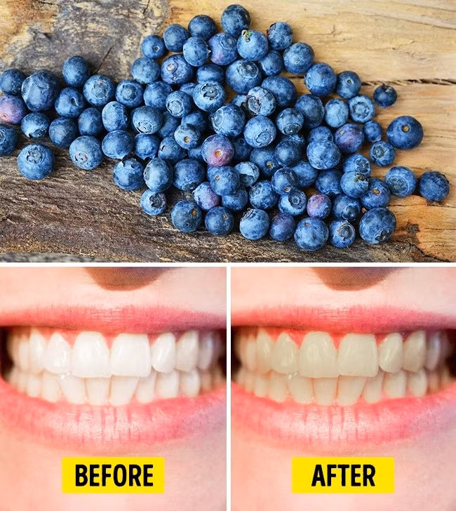 10. Quả việt quất: Quả việt quất làm cho răng ố màu. Tất nhiên, nếu bạn không ăn quả việt quất thường xuyên, điều đó sẽ không xảy ra. Ảnh: Pixabay.